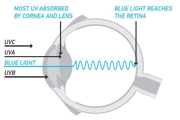 Blue Light Macular Degeneration